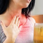 Home Remedies For Acid Reflux