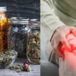 Arthritis Herbal Treatment